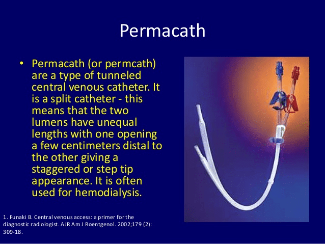Permacath (CPT 36569)