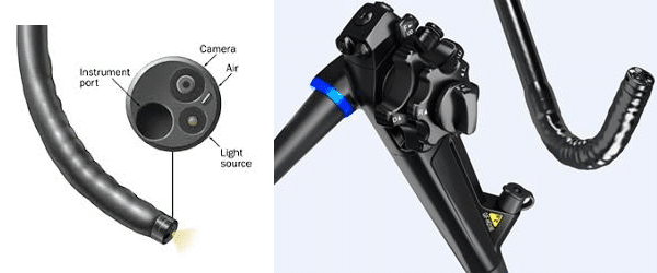 Endoscopia