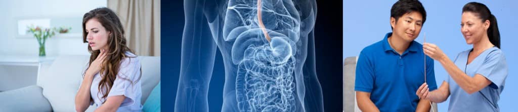 Estudio de Motilidad Gastrointestinal