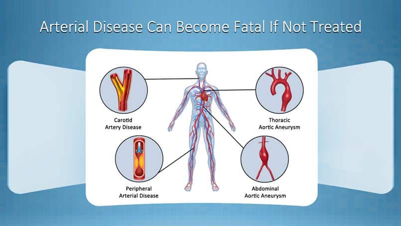 vein arterial