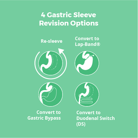Gastric Sleeve Surgery Options