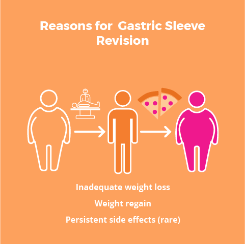 Booklet: Reasons For Gastric Sleeve Revision