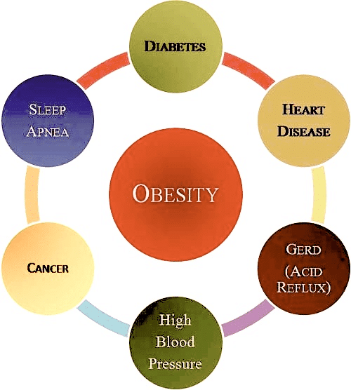 Image Of The Effects Of Obesity