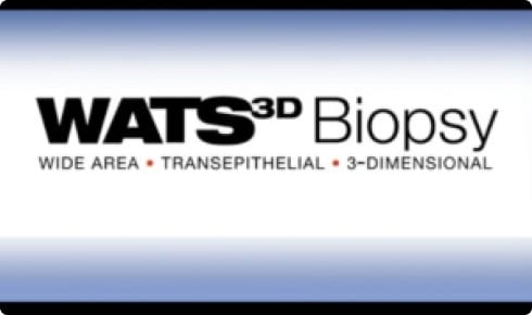 Biopsia de WATS en 3D