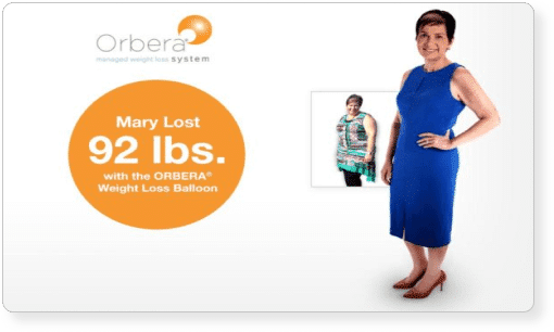 Image Of A Woman Who Lost Weight With The ORBERA Weight Loss Balloon