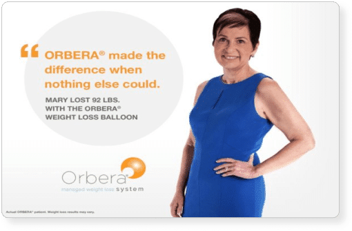 Image Of A Woman Who Recommends The ORBERA® Intragastric Balloon System