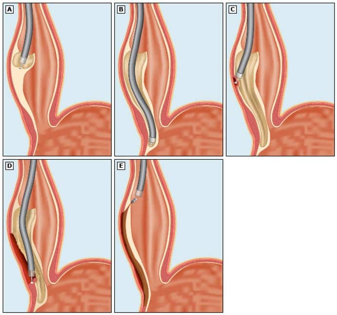 Illustration Poem Procedure