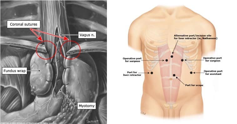 Illustration Poem Procedure