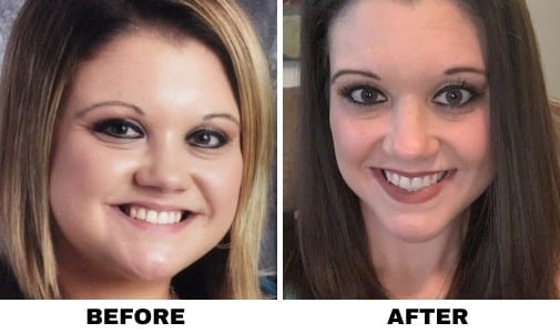 BEFORE & AFTER