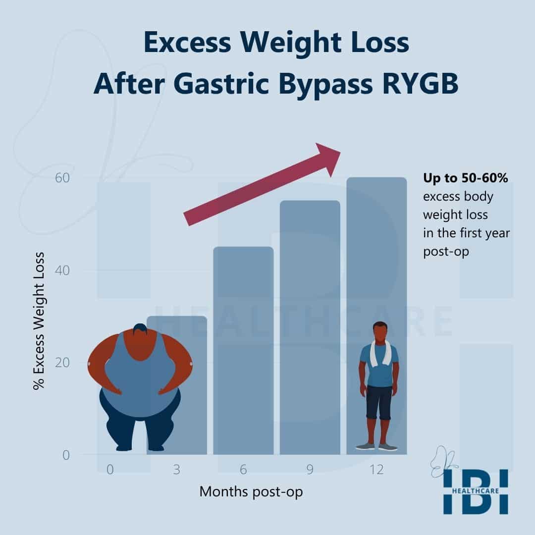 Illustration: Weight Loss After Gastric Bypass Surgery