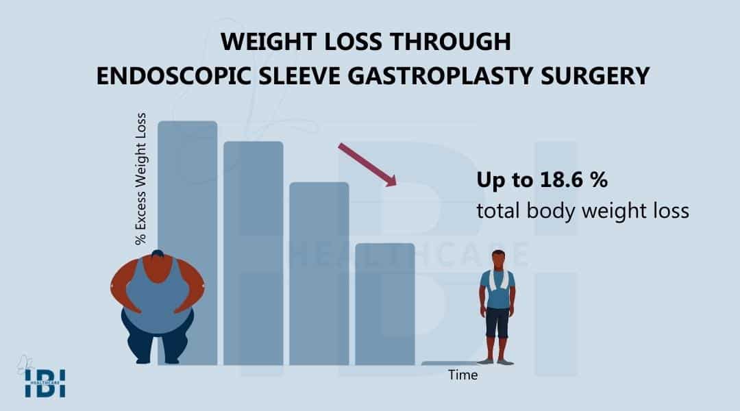 Illustration: Weight loss through ESG surgery