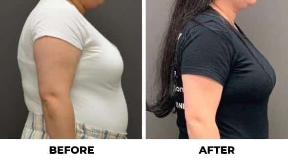 weight loss pills before and after