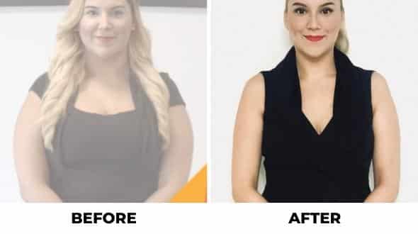 weight loss with orbera balloon before and after