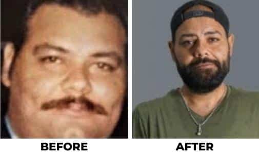 LSG before and after