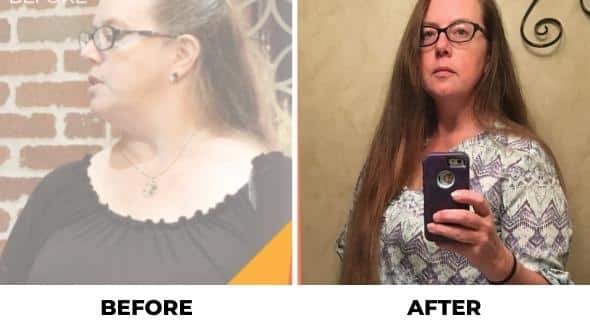 weight loss balloon before and after picture
