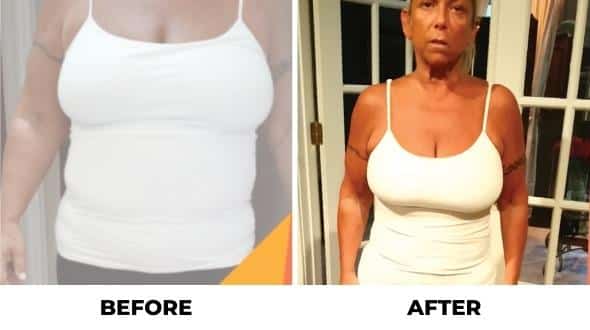 orbera weight loss balloon before and after