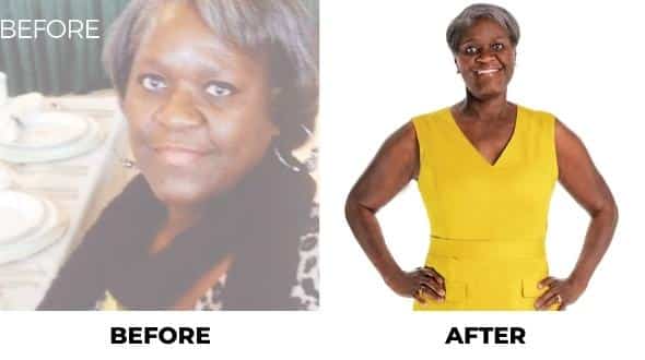 Real Orbera Weight Loss Results