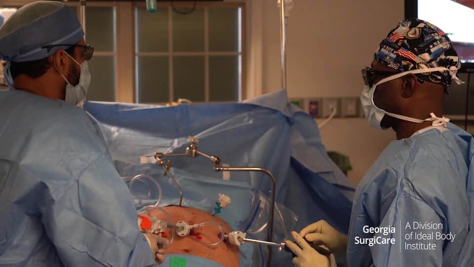 Dr. Chris and Dr. Ahad performing mini gastric bypass surgery