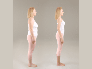 Gastric Sleeve Weight Loss TImeline_Featured Image