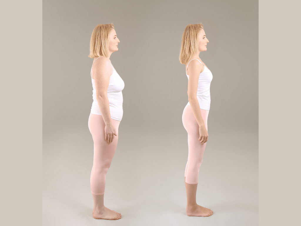 Gastric Sleeve Weight Loss TImeline_Featured Image
