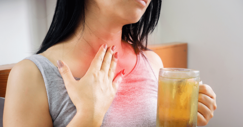 Gastroesophageal Reflux FAQs