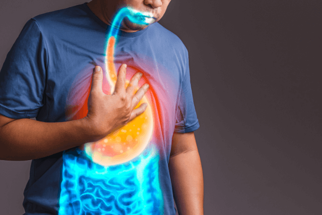 Acid Reflux Symptoms