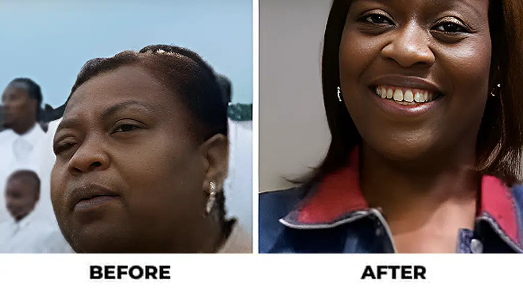 Before and After