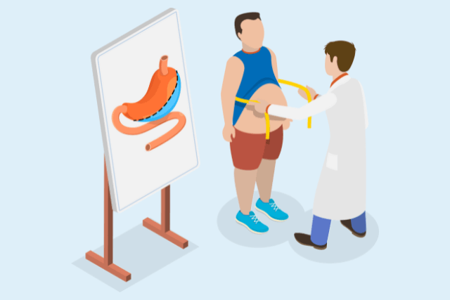 Bariatric Surgery Requirements
