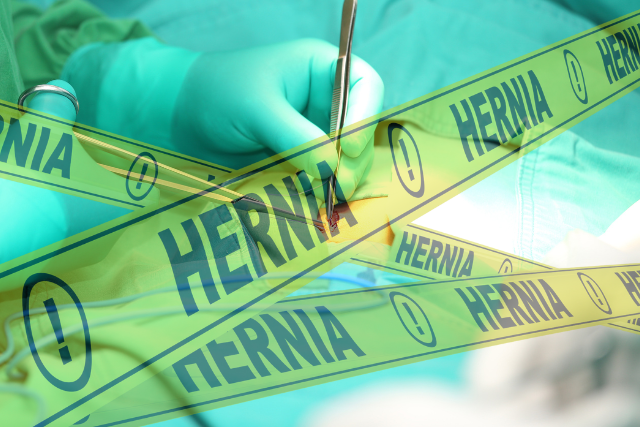 Hiatal Hernia Symptoms and Causes