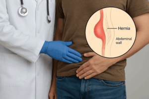 Types of Hernia