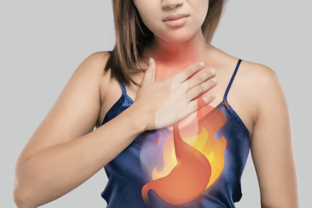 What Is Acid Reflux?