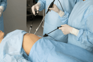 5 Benefits of Laparoscopic Tubal Reversal Over Open Surgery