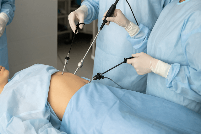 5 Benefits of Laparoscopic Tubal Reversal Over Open Surgery
