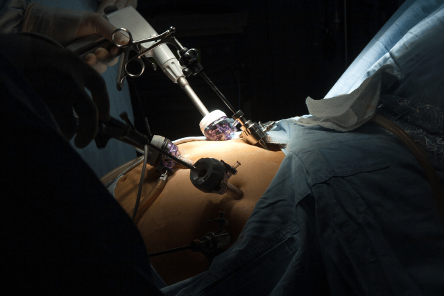Regain Control After Gastric Bypass