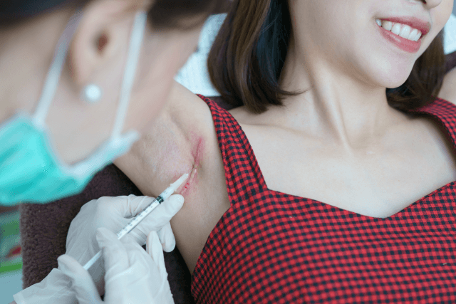 Keloid Treatment in Loganville, Georgia: doctor performing injection treatment for a patient’s armpit keloid