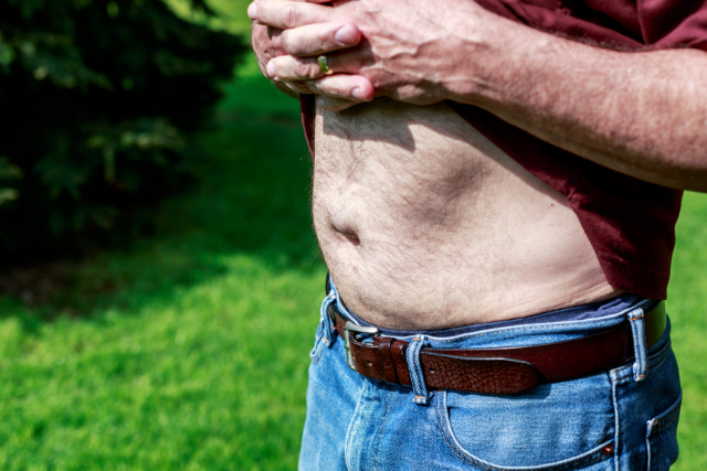Preventing and Treating Hernias