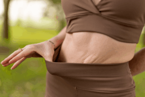 Body Makeover After Major Weight Loss