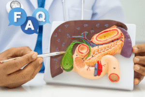 Gallbladder removal FAQ: